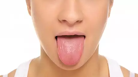 Ce inseamna cand ai pete albe pe limba
