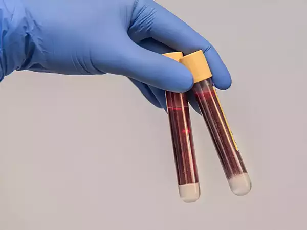 Cea mai rara grupa de sange: mai putin de 50 de oameni din lume au sangele "de aur"
