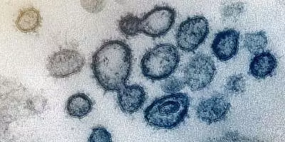 Cum s-ar putea explica numarul mai mic de infectii gripale in contextul pandemiei COVID-19. Ipoteza suprinzatoare a specialistilor