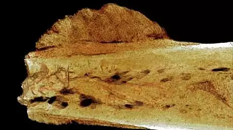 Descoperire socanta a arheologilor in organismul unui om care a trait acum 1,7 milioane ani
