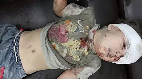 Gest neasteptat al Rusiei, dupa ce fotografiile cu baietelul sirian Omran au devenit virale