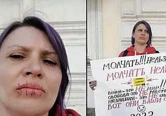 Gest socant facut de o activista rusa! Si-a cusut gura, pentru a protesta impotriva razboiului din Ucraina / FOTO
