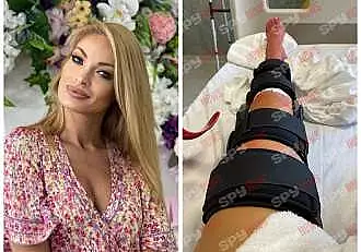 In cat timp se va recupera Valentina Pelinel, dupa ce a fost operata la picior. Sotia lui Cristi Borcea este nevoita sa mearga in carje