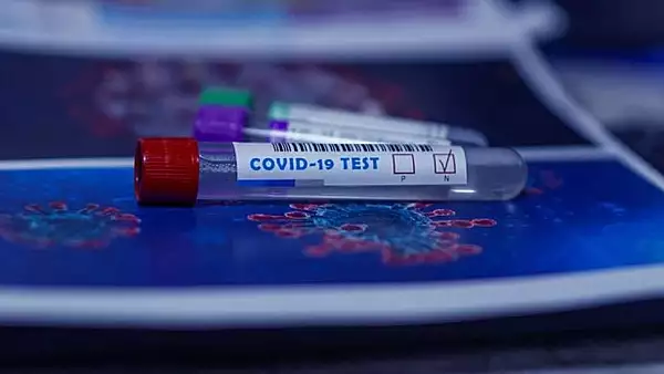 Medicul Adriana Pistol a lamurit misterul testarii COVID-19 pe baza de saliva - DE CE nu poate fi  folosita