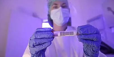 Pregatit de vacanta? Testeaza-te COVID la singurul laborator acreditat RENAR pentru RT-PCR!
