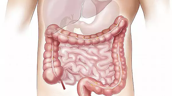 Primele simptome ale cancerului de colon. Semnele care trebuie sa te trimita la doctor