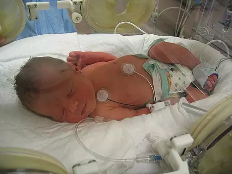 Un doctor a salvat viata unui bebelus nascut prematur. Ce s-a intamplat 30 de ani mai tarziu, ireal!